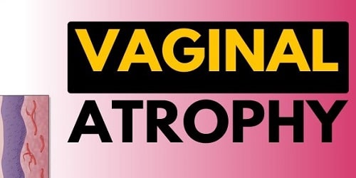 Vaginal Atrophy